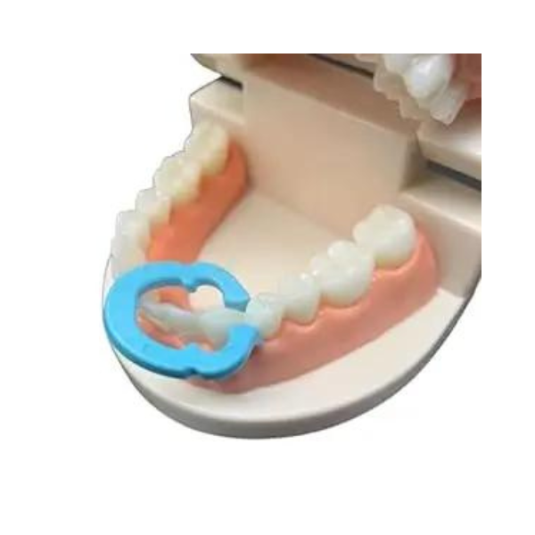 Untitled design (71) Class II Composite Clip (Resin clip)