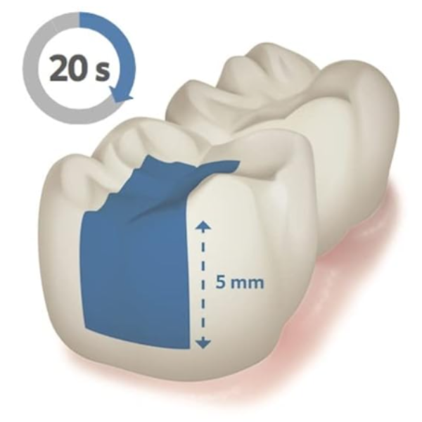 Untitled design - 2024-06-11T170010.594 Nano Bulk Fill Composite