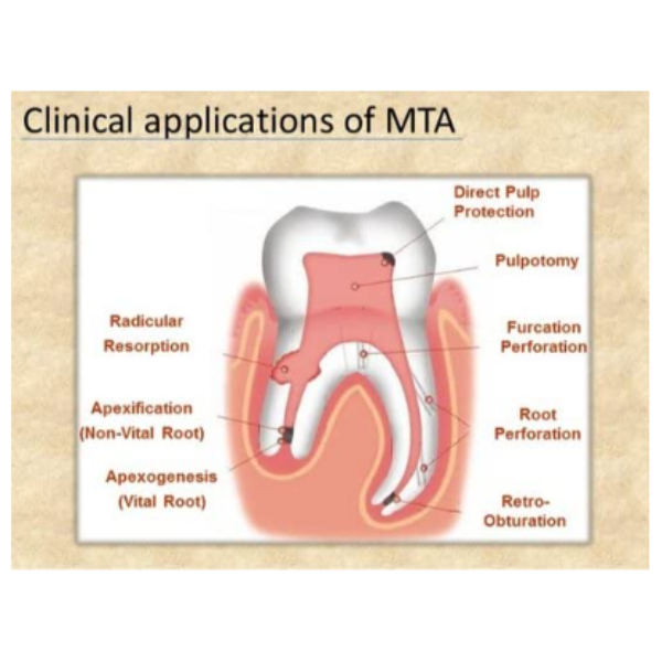 Untitled design - 2024-06-11T183358.940 Root Fix MTA