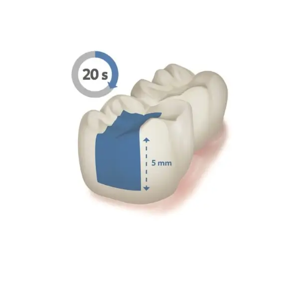Nano Bulk Fill Composite