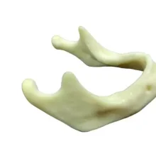 Dental Implant Jaw practice mandible