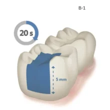 Nano Bulk Fill Composite